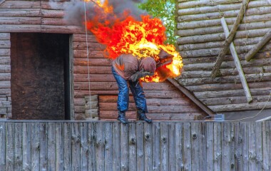 Опік як виробнича травма